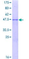 Human RAB8B Protein (Recombinant GST)