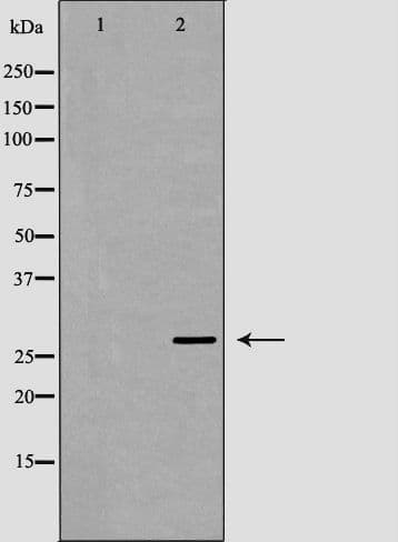 MOG Antibody