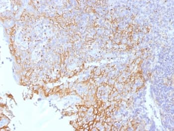 CTNNB1 / Beta Catenin Antibody (clone 5H10)