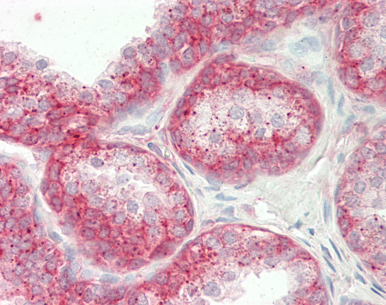ASAH1 / Acid Ceramidase Antibody (N-Terminus)