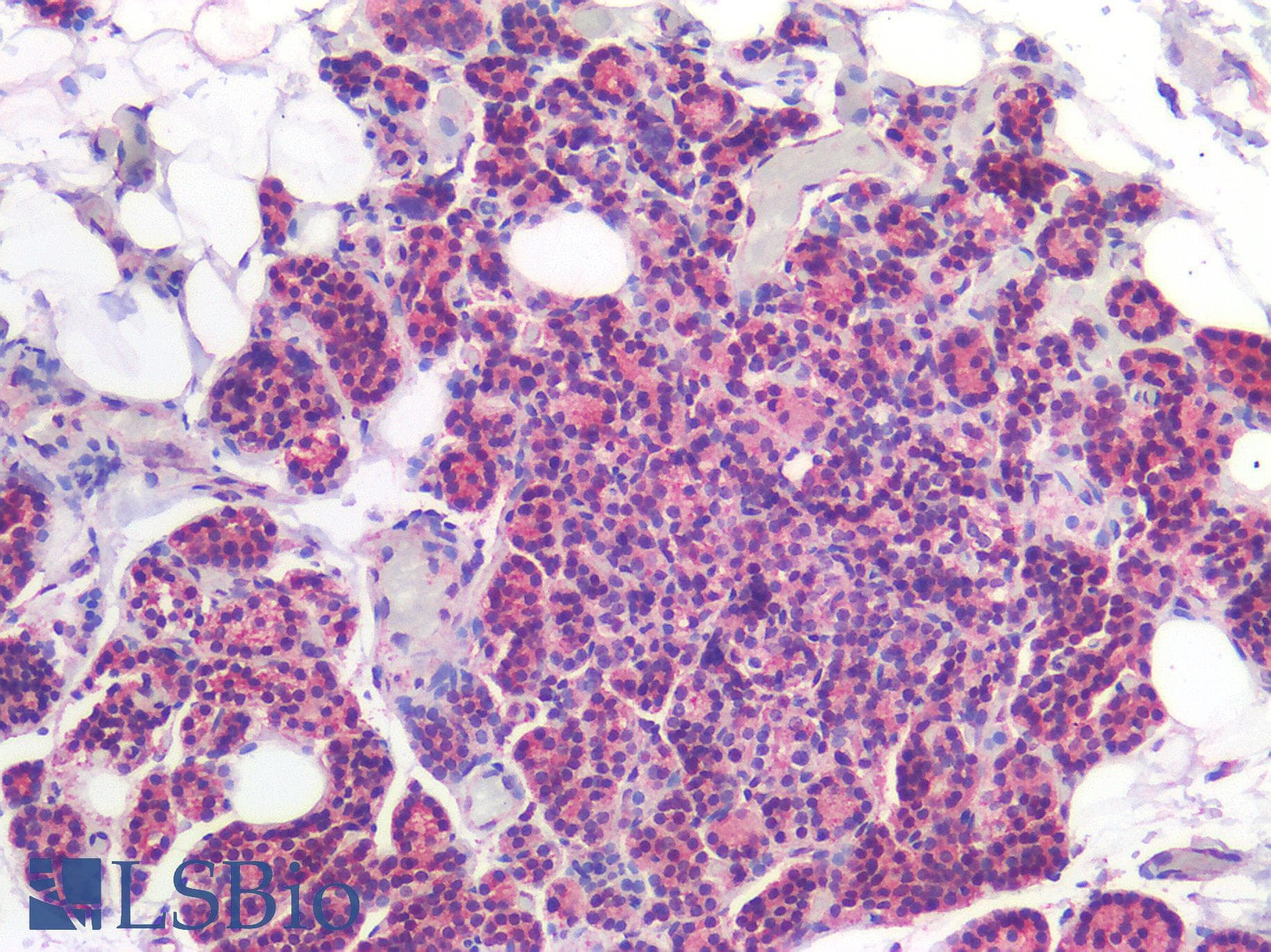 IHC-plus™ ROR1 Antibody (C-terminal)