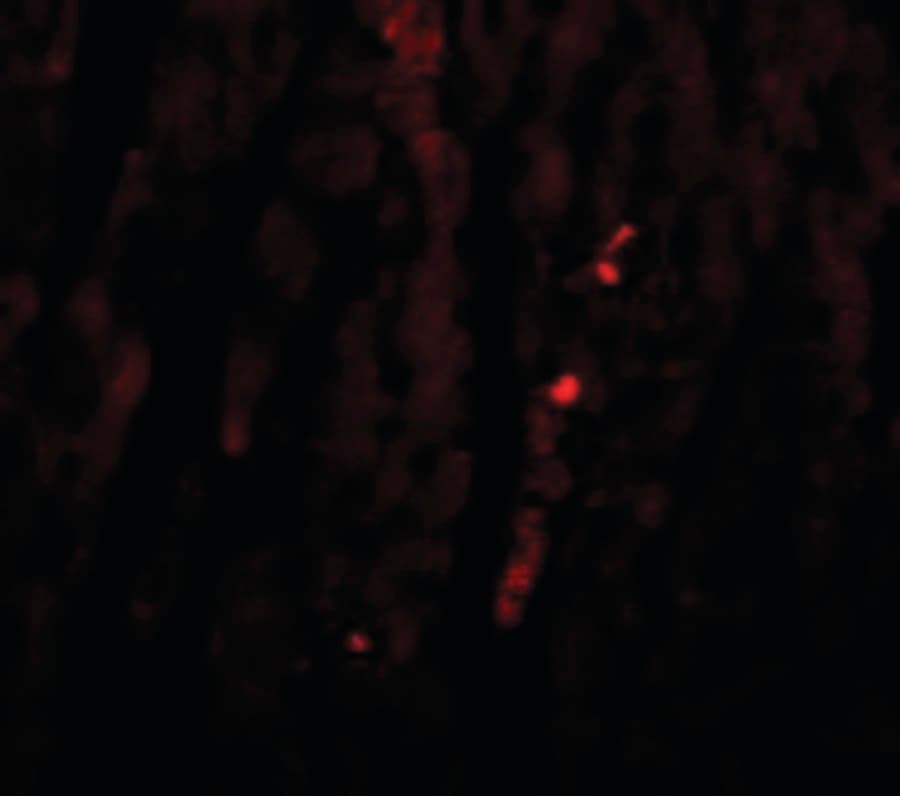 IHC-plus™ KIAA0652 / ATG13 Antibody