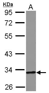 Polyclonal Rabbit anti-Human HIBADH Antibody (IHC, WB)