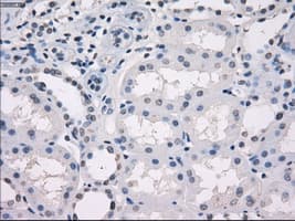 Monoclonal Mouse anti-Human GBP2 Antibody (clone OTI1E5, IHC, IF, WB)