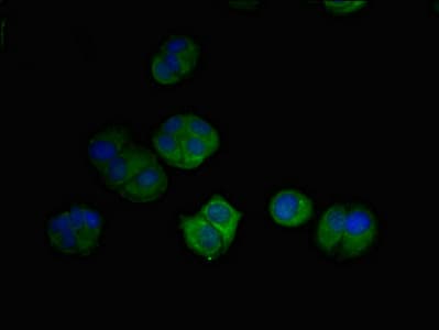 DRAM2 Antibody