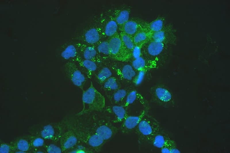 MVP / VAULT1 Antibody