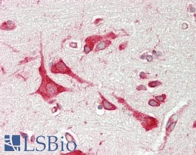 IHC-plus™ PAI-RBP1 / SERBP1 Antibody (aa100-150)