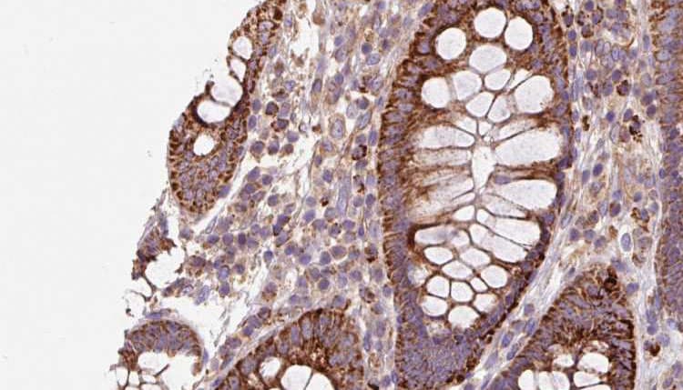 AHCYL1 / DCAL Antibody