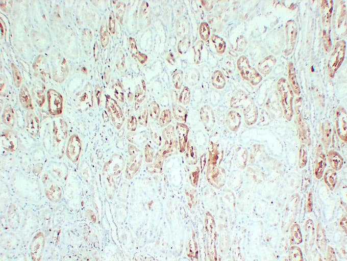 Monoclonal Mouse anti-Human S100A1 / S100-A1 Antibody (clone ABT-S100A1, IHC)