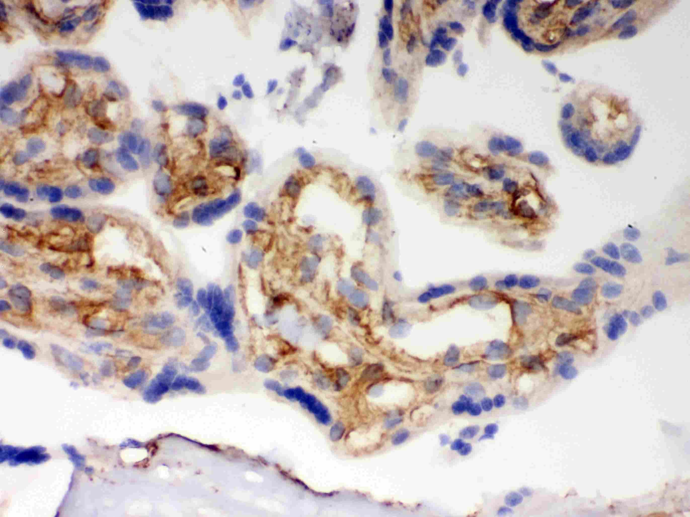BAK1 / BAK Antibody (aa22-211)