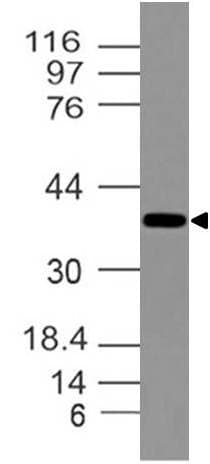 DLX3 Antibody