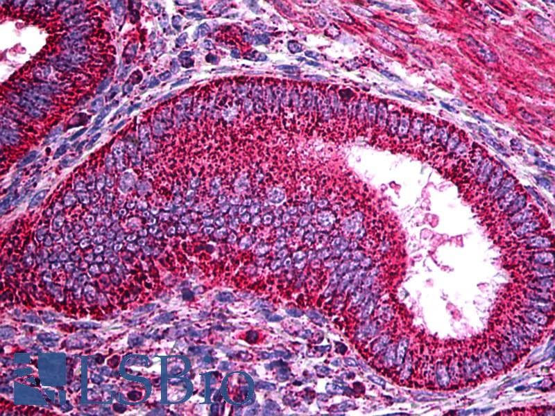 IHC-plus™ Monoclonal Mouse anti-Human TRF1 / TERF1 Antibody (clone BED5, IHC)