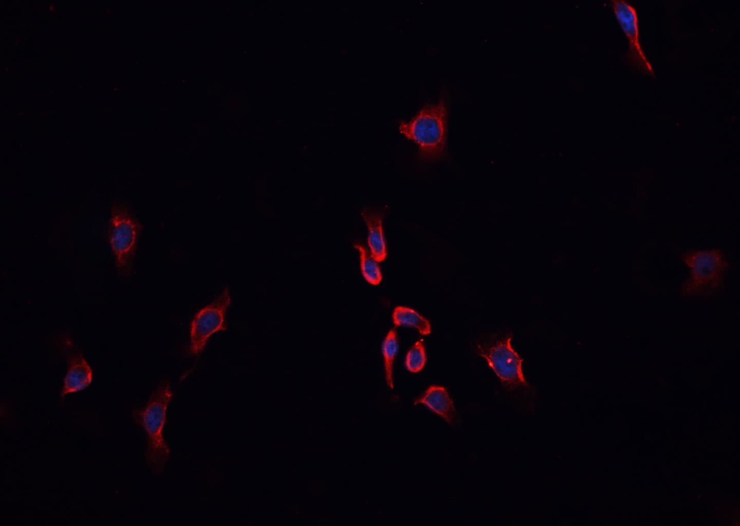 Polyclonal Rabbit anti-Human ABO Glycosyltransferase Antibody (IHC, IF, WB)