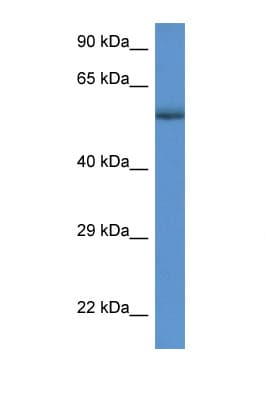 Polyclonal Rabbit anti-Human GBA / Glucosidase Beta Acid Antibody (C-Terminus, WB)