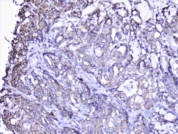 Polyclonal Rabbit anti-Human CTTN / Cortactin Antibody (IHC, IF, WB)