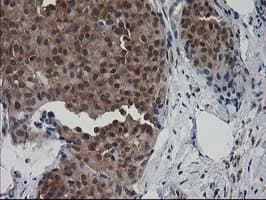 DSTN / Destrin Antibody (clone OTI1D8)