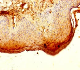 ALG12 Antibody