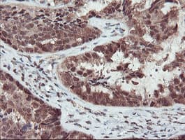 TRAIP / TRIP Antibody (aa67-313, clone OTI2D4, Carrier-free)