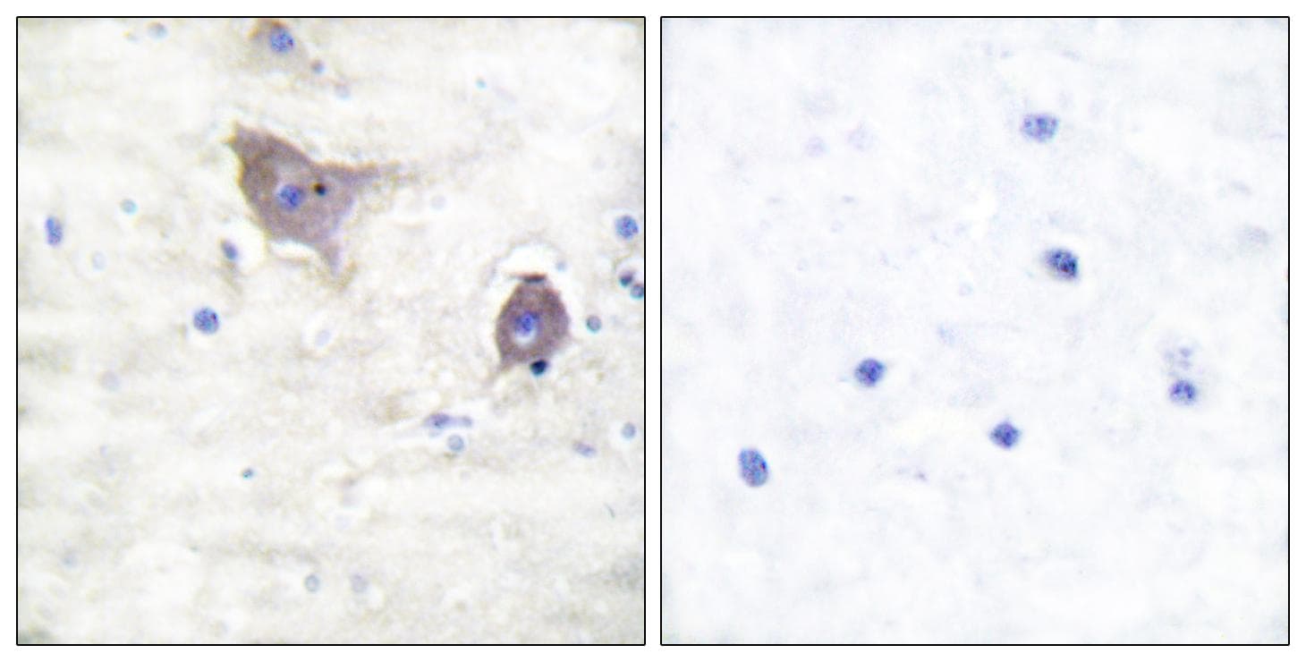 SNCB / Beta-Synuclein Antibody