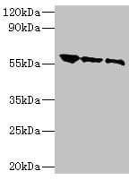 Rabies Virus gG Antibody (aa20-459)