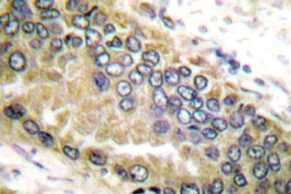 TGFB2 / TGF Beta2 Antibody (Leu388)