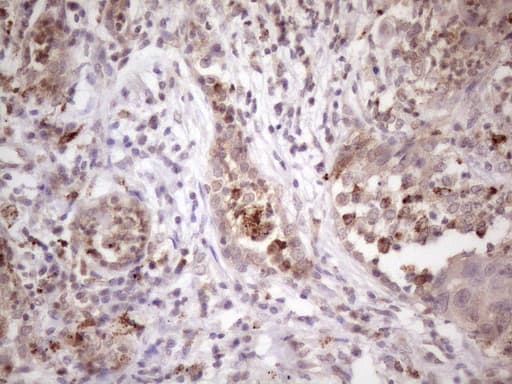 Monoclonal Mouse anti-Human C1orf106 Antibody (clone OTI6A6, aa1-270, IHC, WB)