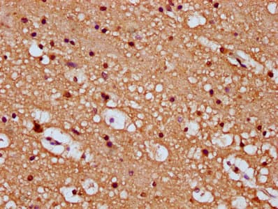 SEMA6B / Semaphorin 6B Antibody