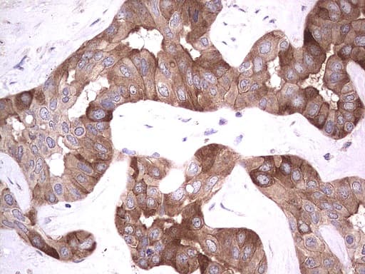 R1 / RRM1 Antibody (aa541-792, clone UMAB165)