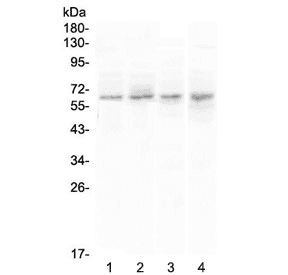 CCKBR / Cckb Antibody