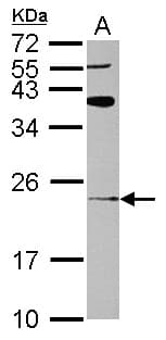 ARL8B Antibody