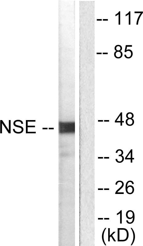 IHC-plus™ ENO2 / NSE Antibody (aa371-420)