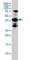 UROD Antibody (clone 1G4)