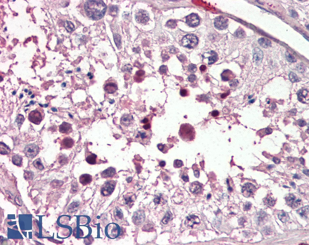 IHC-plus™ Polyclonal Goat anti-Human PIAS2 / PIASX Antibody (aa431-445, IHC)