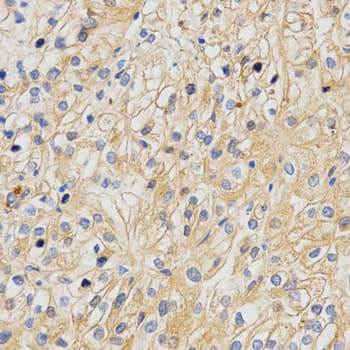 Polyclonal Rabbit anti-Human APLP2 Antibody (IHC, IF, WB)