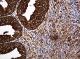 Monoclonal Mouse anti-Human TAPBPL / TAPBPR Antibody (clone OTI3D8, IHC, WB)