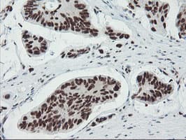 TPRKB Antibody (clone OTI3H3)