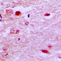 E2F6 Antibody (Internal)