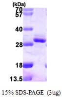 Human RGS2 Protein (Recombinant His)