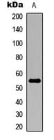 IHC-plus™ RALDH2 / ALDH1A2 Antibody (C-Terminus)