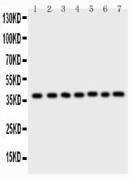 ARA9 / AIP Antibody (aa91-330)