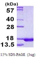 Human RPLP2 Protein (Recombinant His)