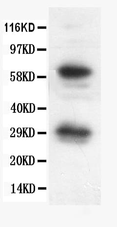 BCL2L1 / BCL-XL Antibody