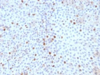 TOP2A / Topoisomerase II Alpha Antibody (clone TOP2A/1361, Azide-free, BSA-free)