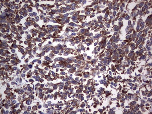ANO1 / DOG1 / TMEM16A Antibody (aa1-333, clone OTI1C8)