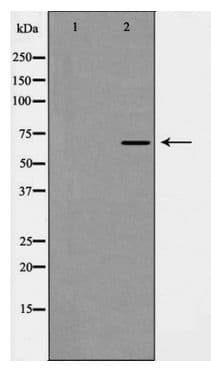 Polyclonal Rabbit anti-Human KEAP1 Antibody (IHC, IF, WB)