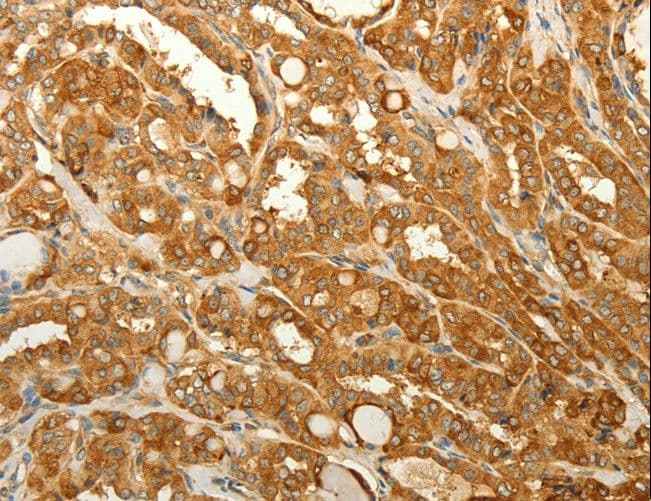 RAB35 Antibody