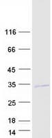 Human VENTX Protein (Recombinant Myc-DDK (Flag))