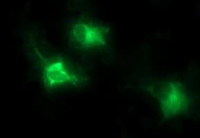 MMP13 Antibody (aa104-471, clone OTI2A6)
