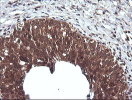 CTAG1B / NY-ESO-1 Antibody (clone OTI4C12)