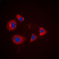 IHC-plus™ PRKAR1A Antibody (C-Terminus)